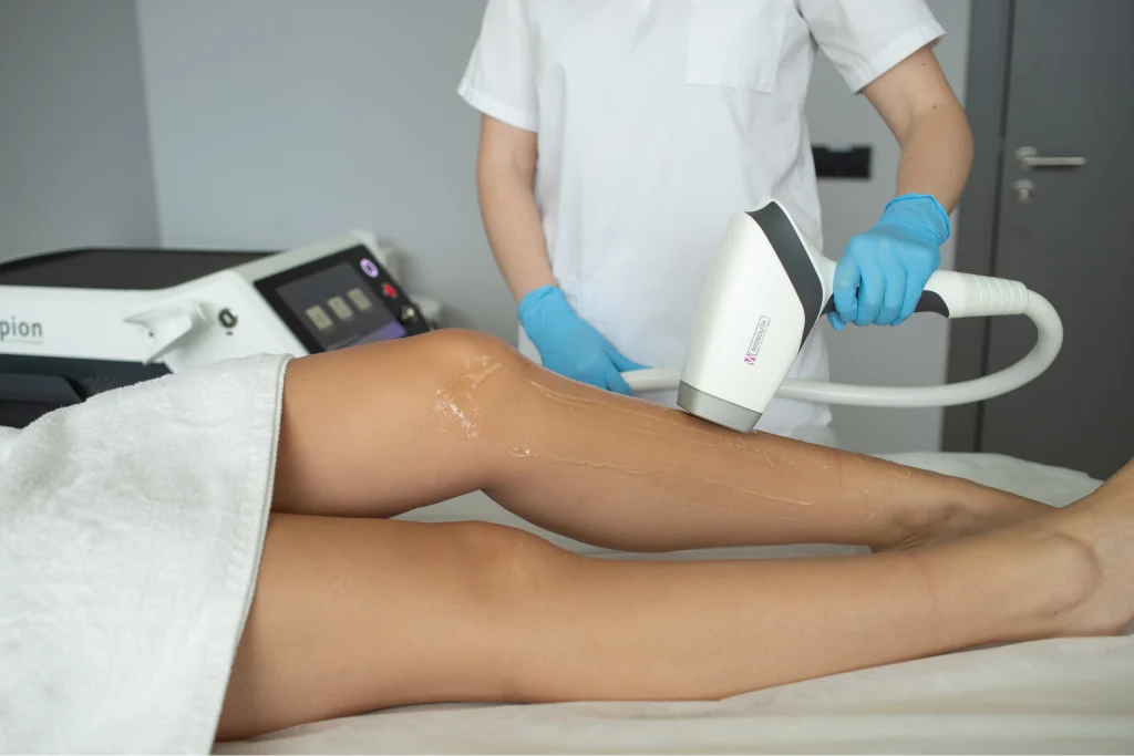 Laserepilatsioon Tallinnas